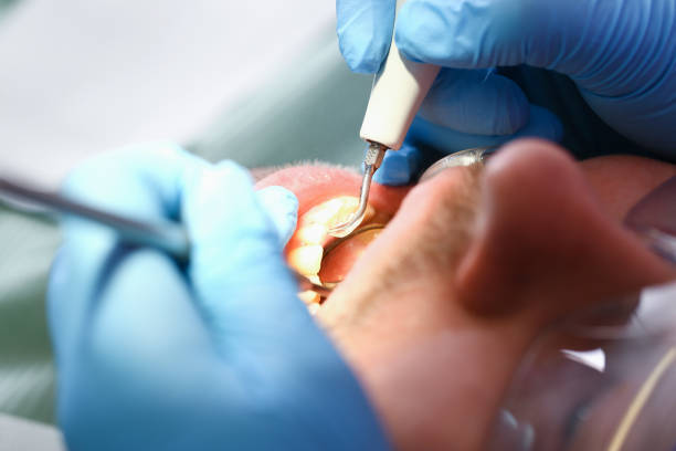 Best Emergency TMJ Treatment in Diboll, TX