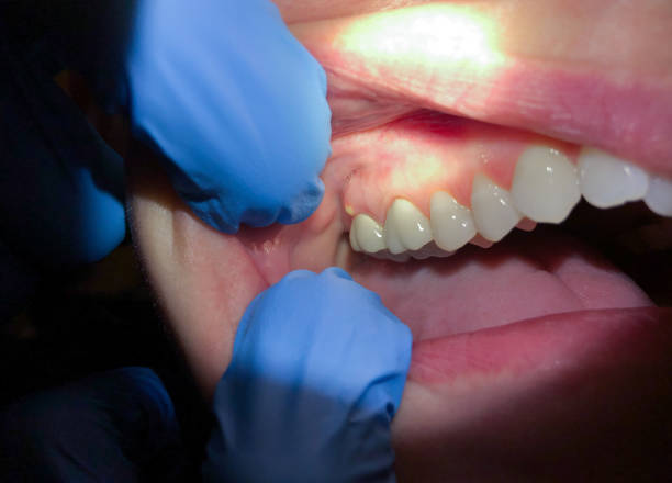 Best After-Hours Dental Trauma Care in Diboll, TX