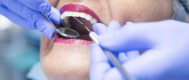 Best Emergency Treatment for Dental Infections or Abscesses in Diboll, TX